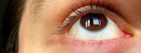 Глазные аллергии и сезонный конъюнктивит